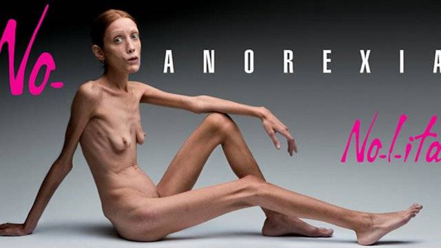Anoreksja