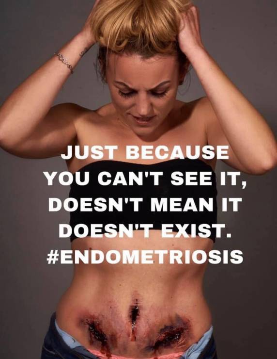 Endometrioza: co dzieje się w ciele kobiety chorej na endometriozę? Szokujące zdjęcia